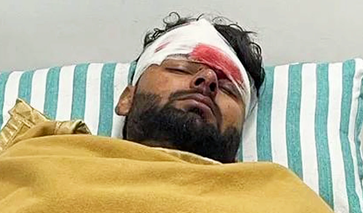 Rishabh Pant Car Accident |  एक्सिडेंट के बाद ऋषभ पंत का चल रहा अस्पताल में इलाज, खेल जगत ने शीघ्र स्वस्थ होने की कामना की