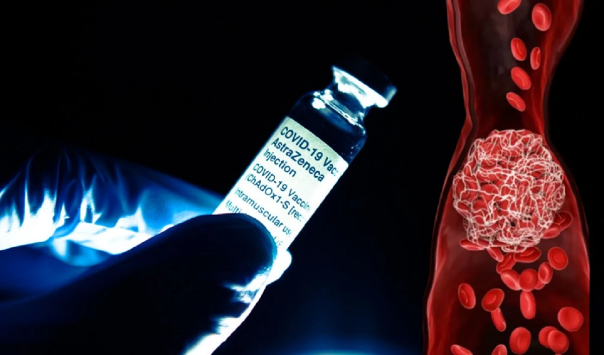 घातक खून के थक्के… AstraZeneca Corona Vaccine को लेकर शोधकर्ताओं ने अब क्या नया पाया