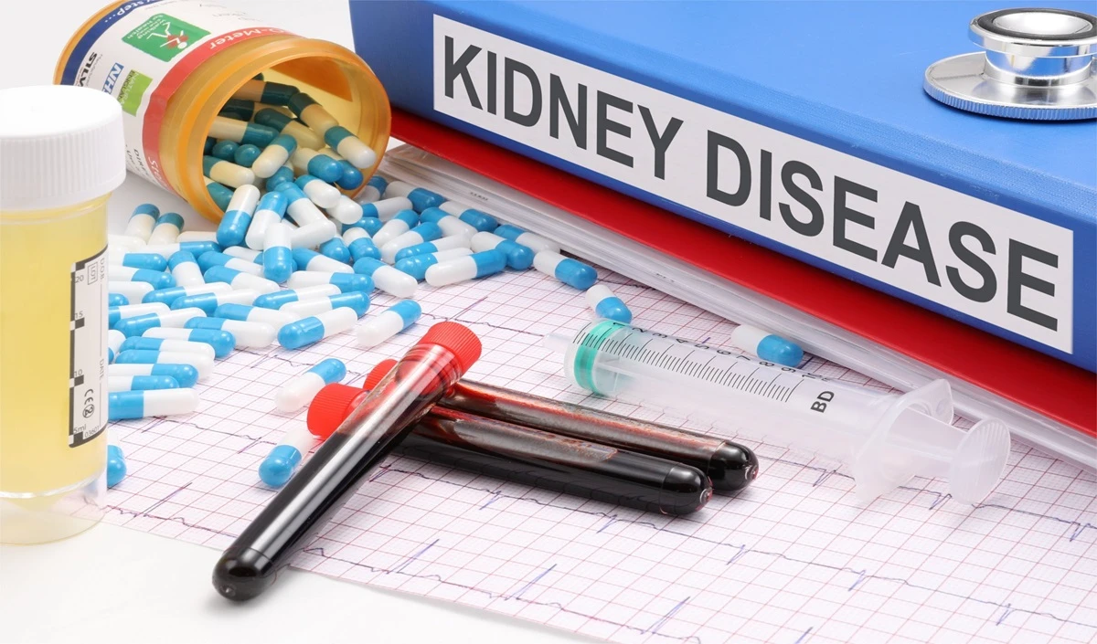 Health Tips: अधिक मीठा खाने से क्यों खराब हो जाती है किडनी, वरना खराब हो सकती है सेहत