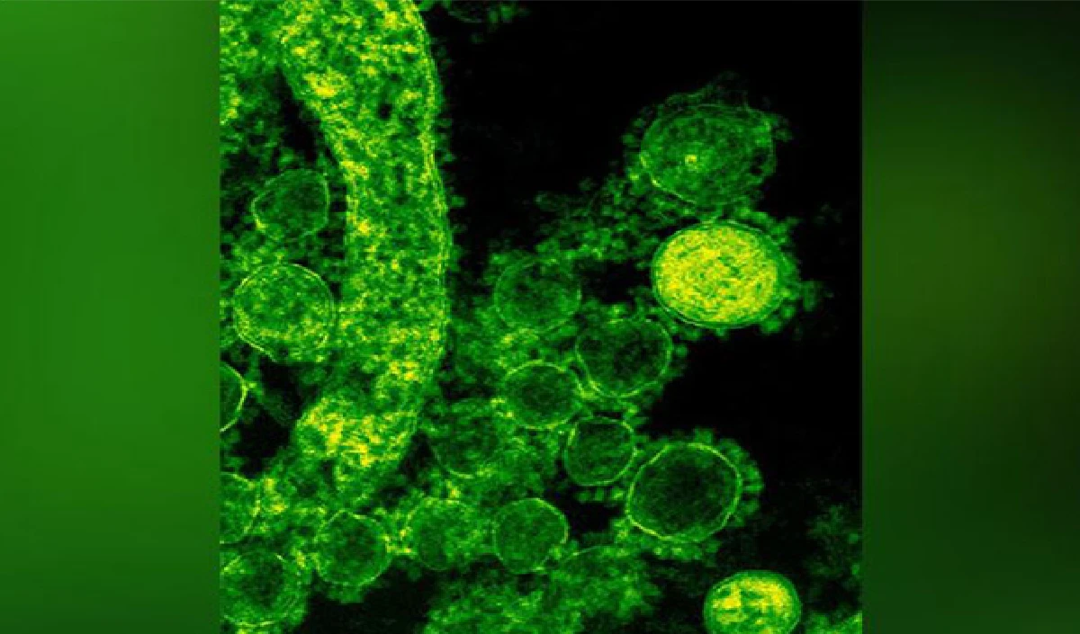 Nipah Virus: केरल में निपाह वायरस ने फिर दी दस्तक, दो केस मिले, स्वास्थ्य विभाग ने जारी किया अलर्ट