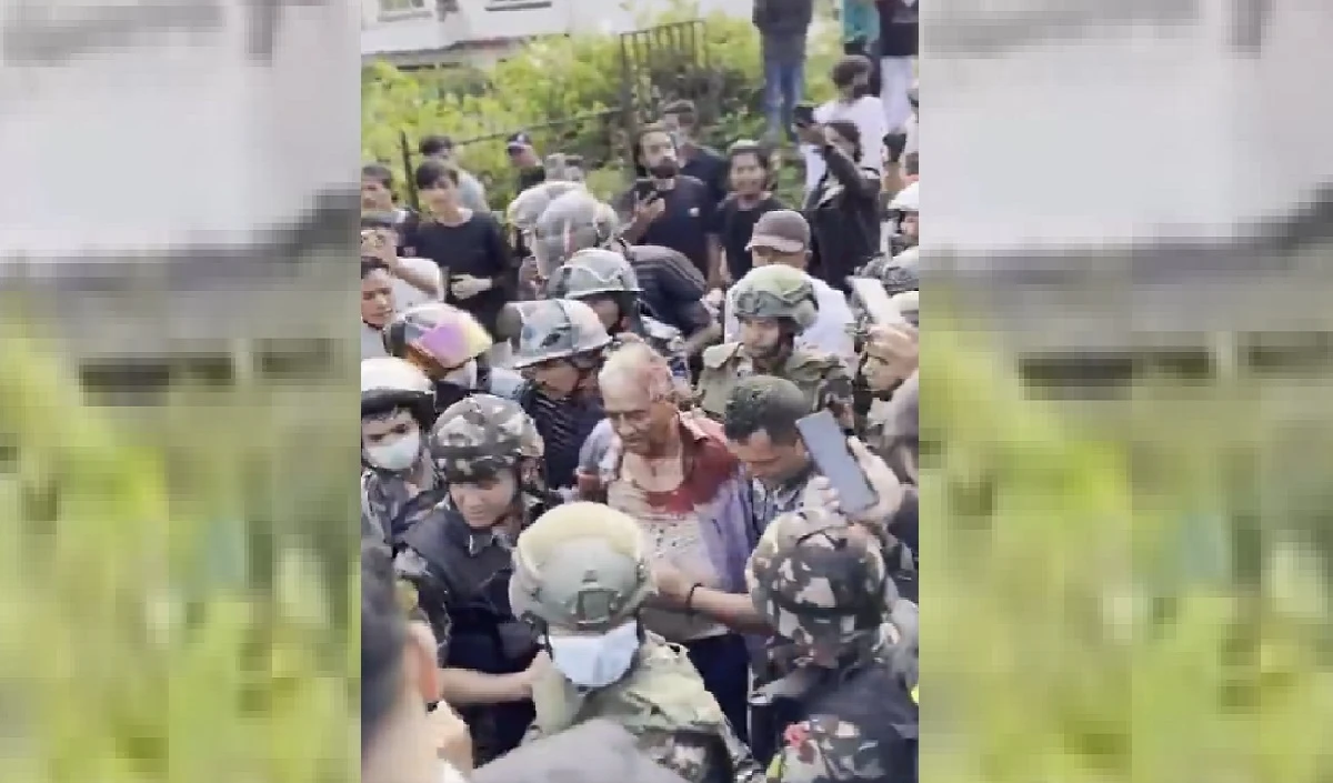 नेपाल में पूर्व PM और उनकी पत्नी को Gen Z ने खूब पीटा, सिर से टपक रहा था खून