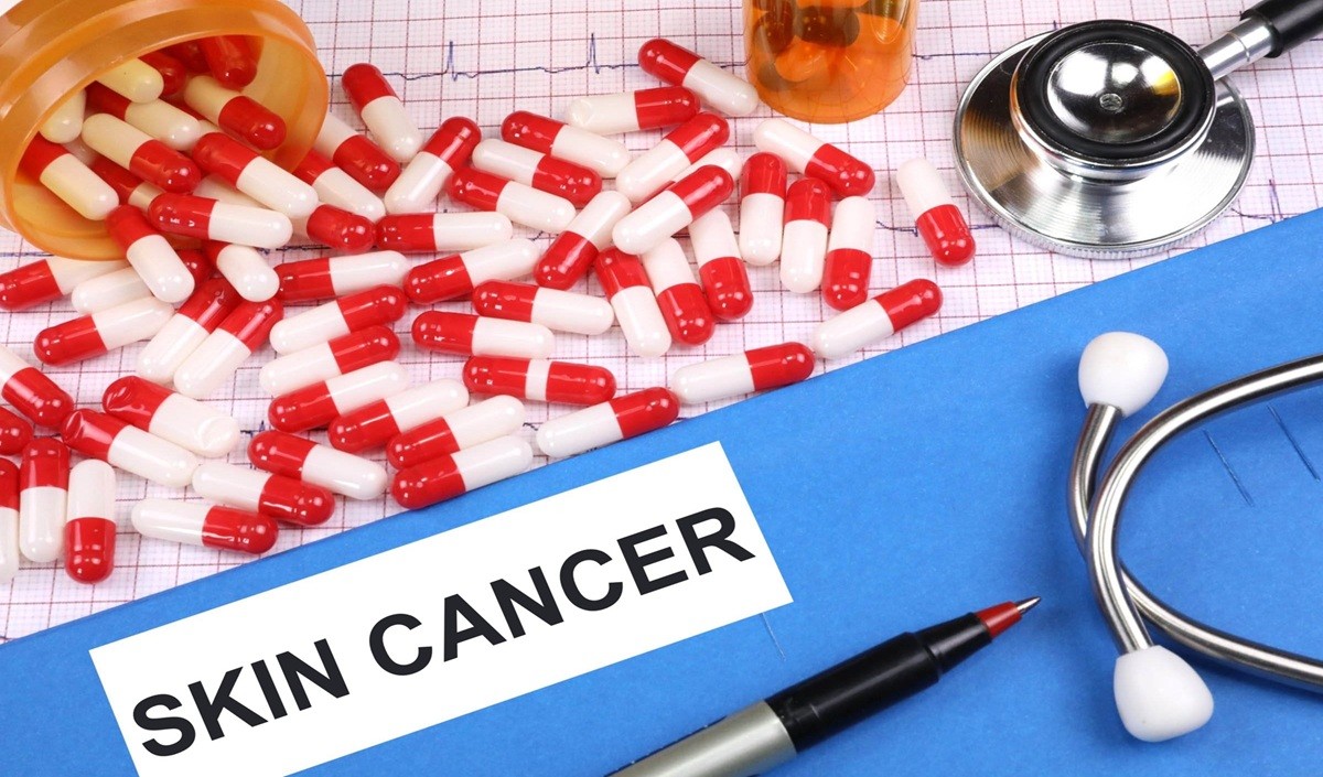 Health Tips: मामूली Sunburn को न करें नजरअंदाज, बढ़ सकता है Skin Cancer का जानलेवा खतरा